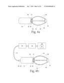 Method to treat gastric reflux via the detection and ablation of gastro-esophageal nerves and receptors diagram and image