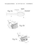 Method to treat gastric reflux via the detection and ablation of gastro-esophageal nerves and receptors diagram and image