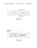 Method to treat gastric reflux via the detection and ablation of gastro-esophageal nerves and receptors diagram and image