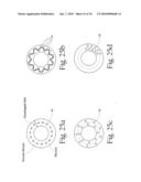 Method to treat gastric reflux via the detection and ablation of gastro-esophageal nerves and receptors diagram and image