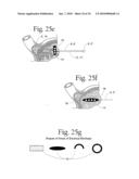 Method to treat gastric reflux via the detection and ablation of gastro-esophageal nerves and receptors diagram and image