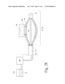 Method to treat gastric reflux via the detection and ablation of gastro-esophageal nerves and receptors diagram and image