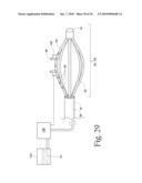 Method to treat gastric reflux via the detection and ablation of gastro-esophageal nerves and receptors diagram and image