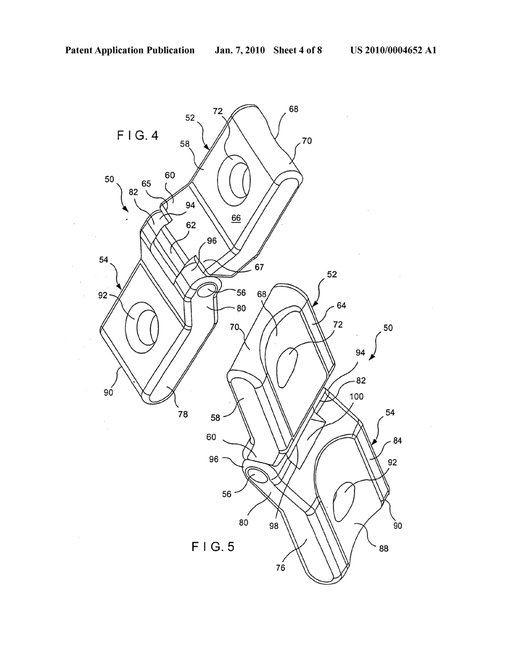 Orthopedic method for correcting angular bone deformity - diagram, schematic, and image 05