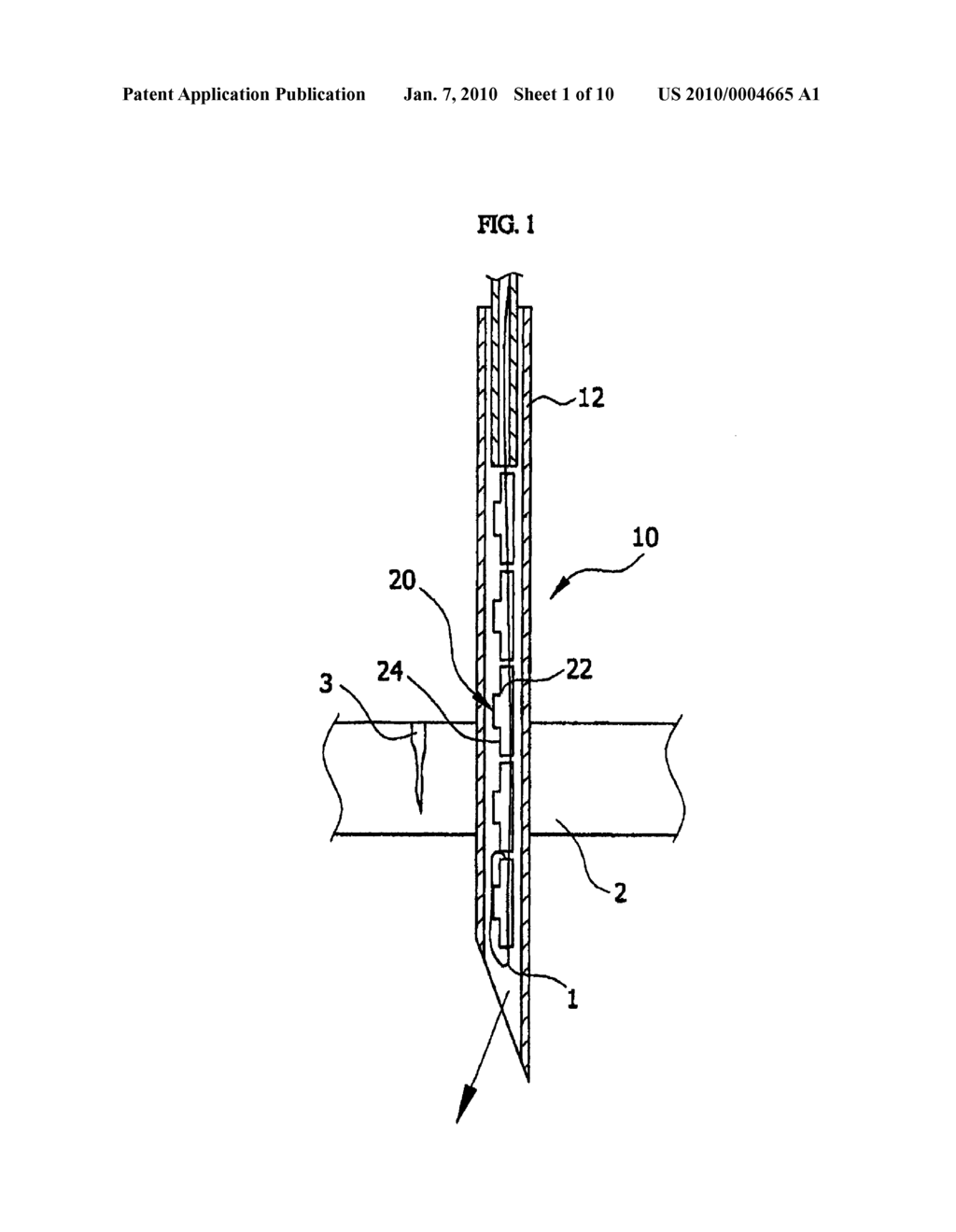 BEAD FOR STITCHING, VACUUM CAP FOR SUCTION INTERNAL ORGAN AND APPARATUS FOR STITCHING INTERNAL ORGAN USING THE SAME - diagram, schematic, and image 02