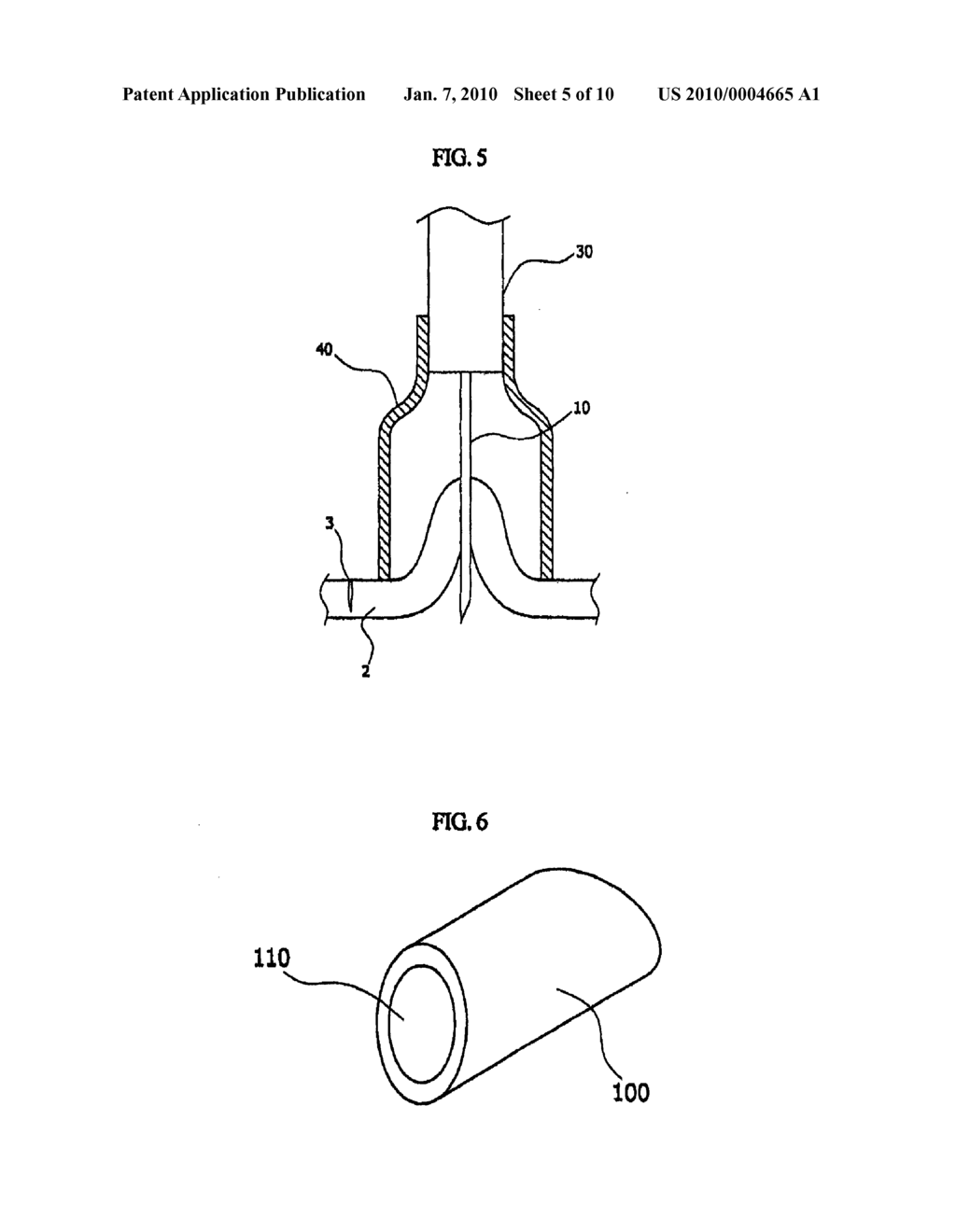 BEAD FOR STITCHING, VACUUM CAP FOR SUCTION INTERNAL ORGAN AND APPARATUS FOR STITCHING INTERNAL ORGAN USING THE SAME - diagram, schematic, and image 06