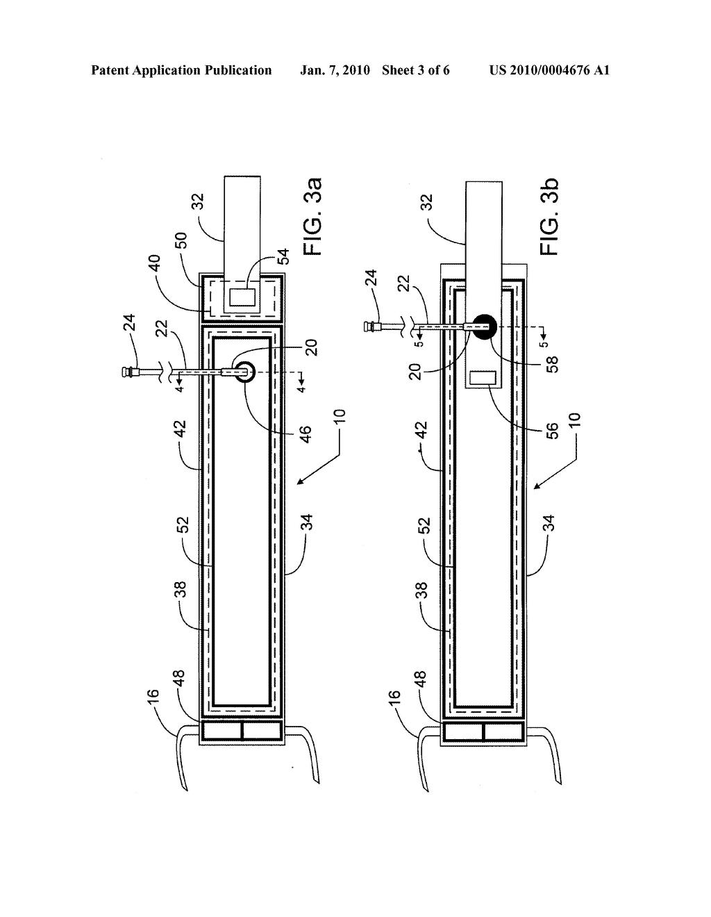 Low-Cost Disposable Tourniquet Cuff - diagram, schematic, and image 04