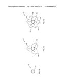 WOUND CLOSURE METHODS diagram and image