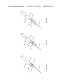 WOUND CLOSURE METHODS diagram and image