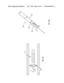 WOUND CLOSURE METHODS diagram and image