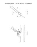 WOUND CLOSURE METHODS diagram and image