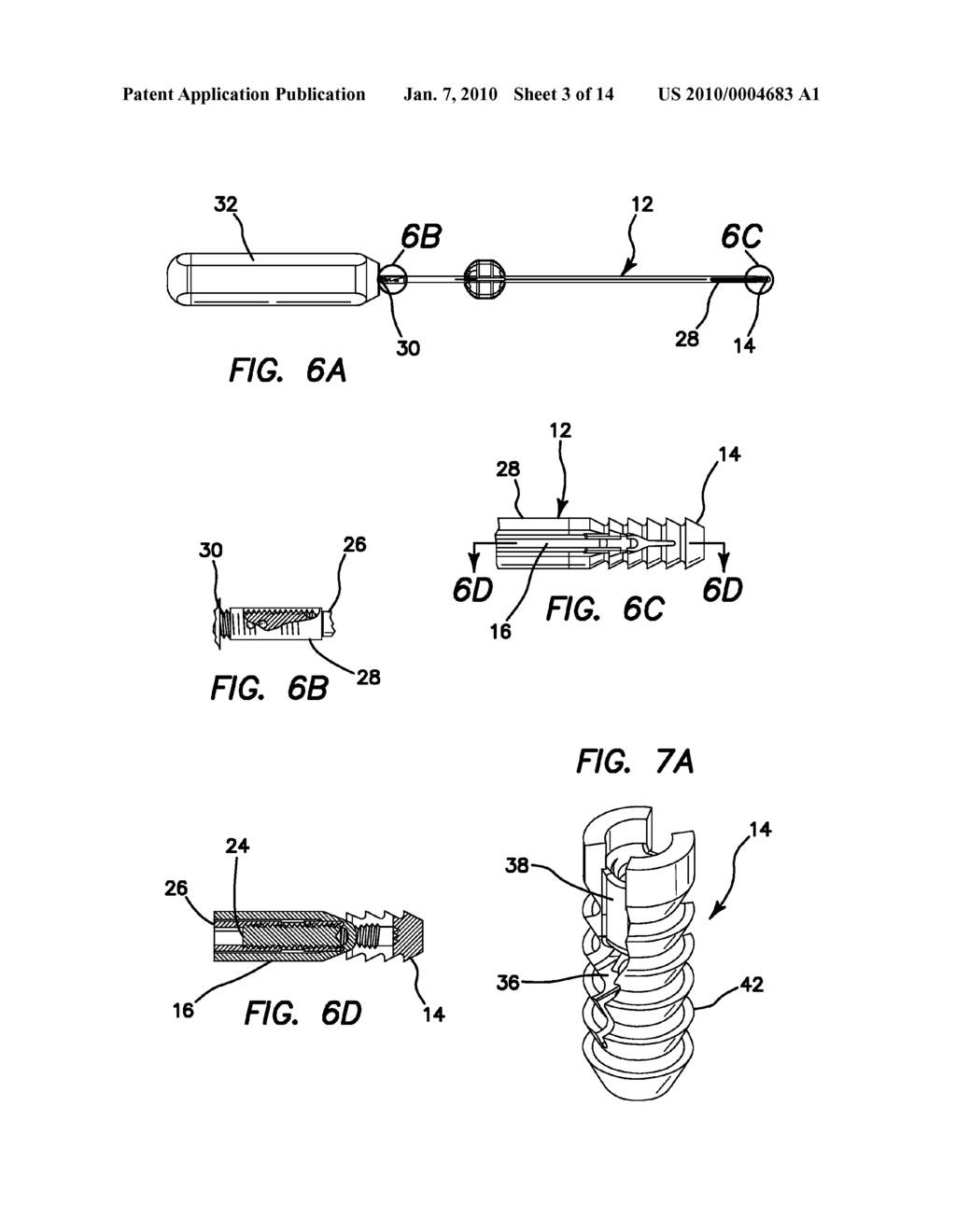 ANCHORS AND METHOD FOR SECURING SUTURE TO BONE - diagram, schematic, and image 04