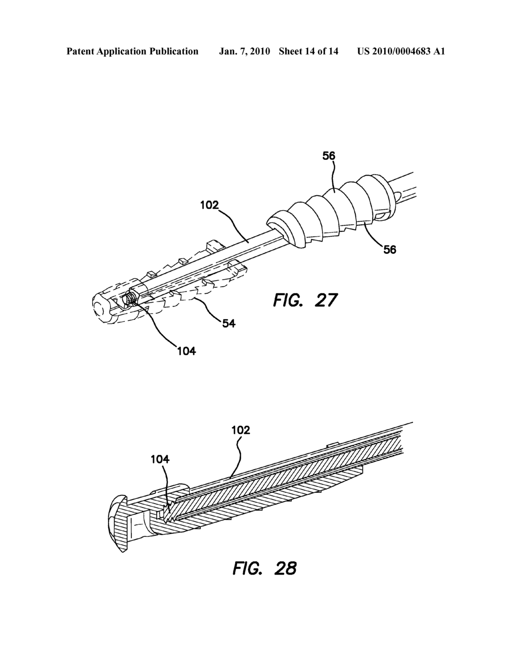 ANCHORS AND METHOD FOR SECURING SUTURE TO BONE - diagram, schematic, and image 15