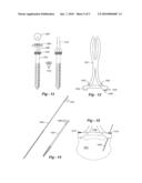 POSTERIOR SPINAL RECONSTRUCTION SYSTEM diagram and image