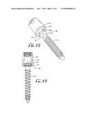 Screw assembly diagram and image