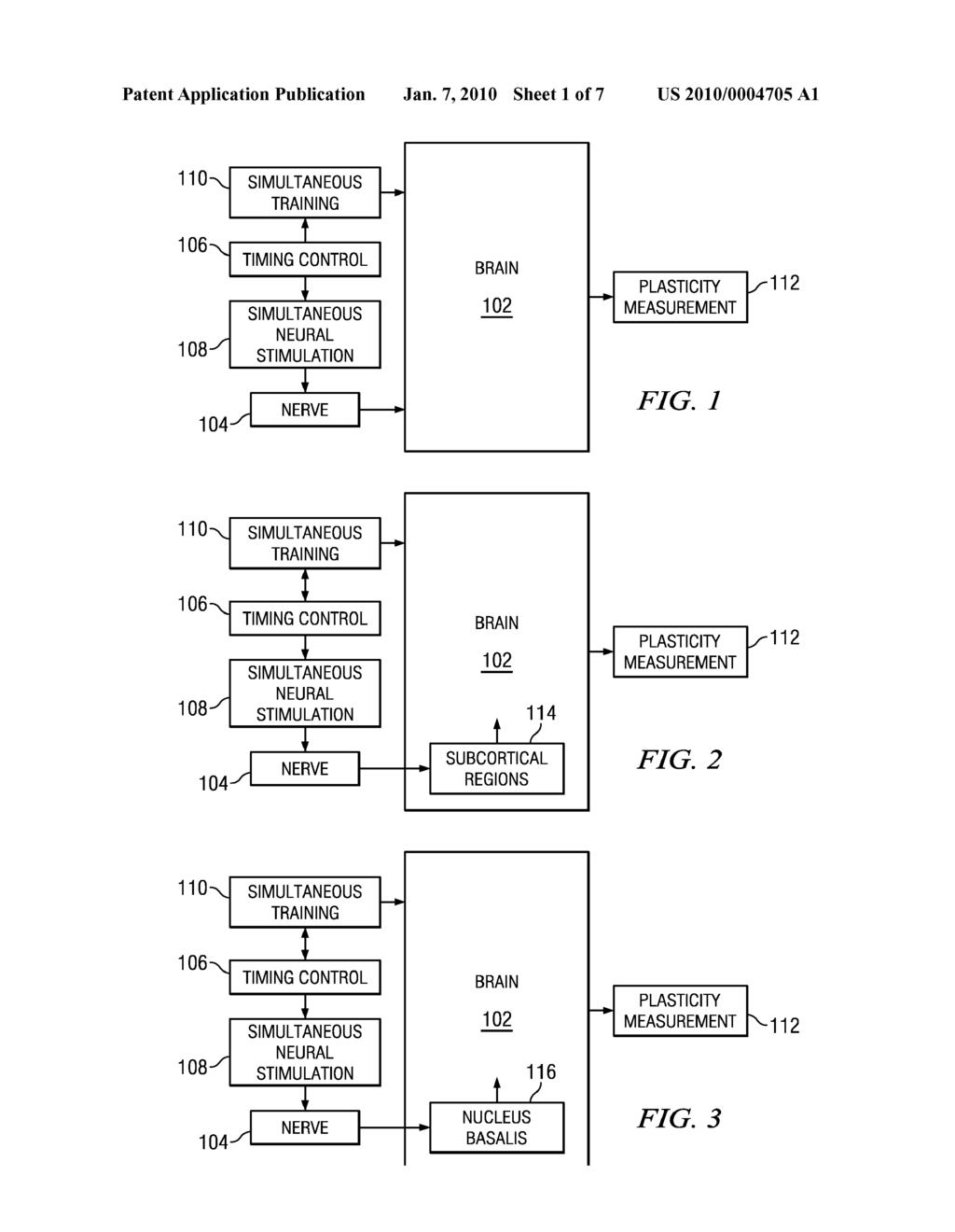 Systems, Methods and Devices for Treating Tinnitus - diagram, schematic, and image 02