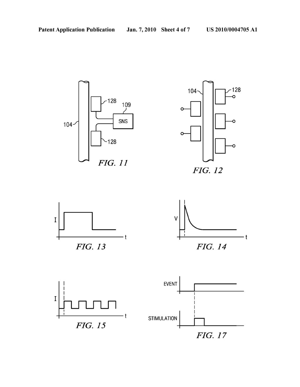 Systems, Methods and Devices for Treating Tinnitus - diagram, schematic, and image 05