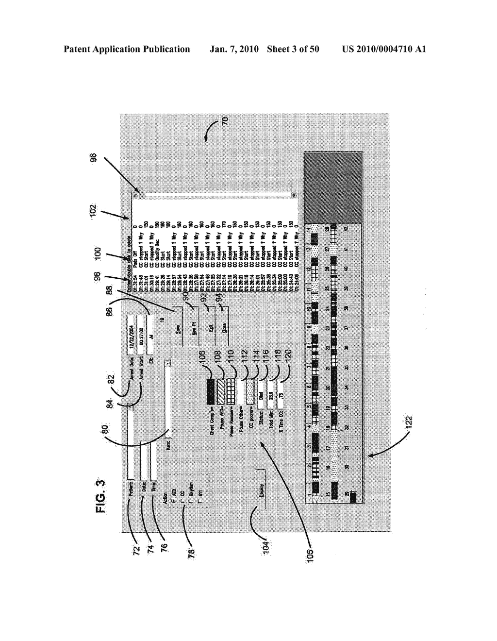 CPR ANALYSIS SYSTEM AND METHOD - diagram, schematic, and image 04