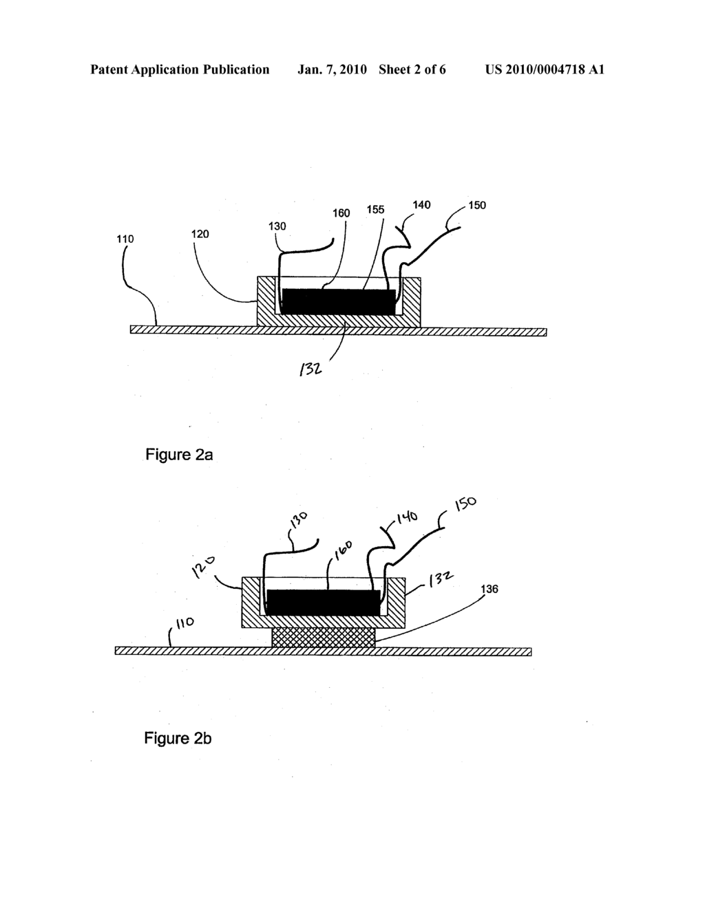 IMPLANTABLE MEDICAL DEVICE WITH INTEGRATED ACOUSTIC TRANSDUCER - diagram, schematic, and image 03