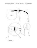 IMPLANTABLE MEDICAL DEVICE WITH INTEGRATED ACOUSTIC TRANSDUCER diagram and image