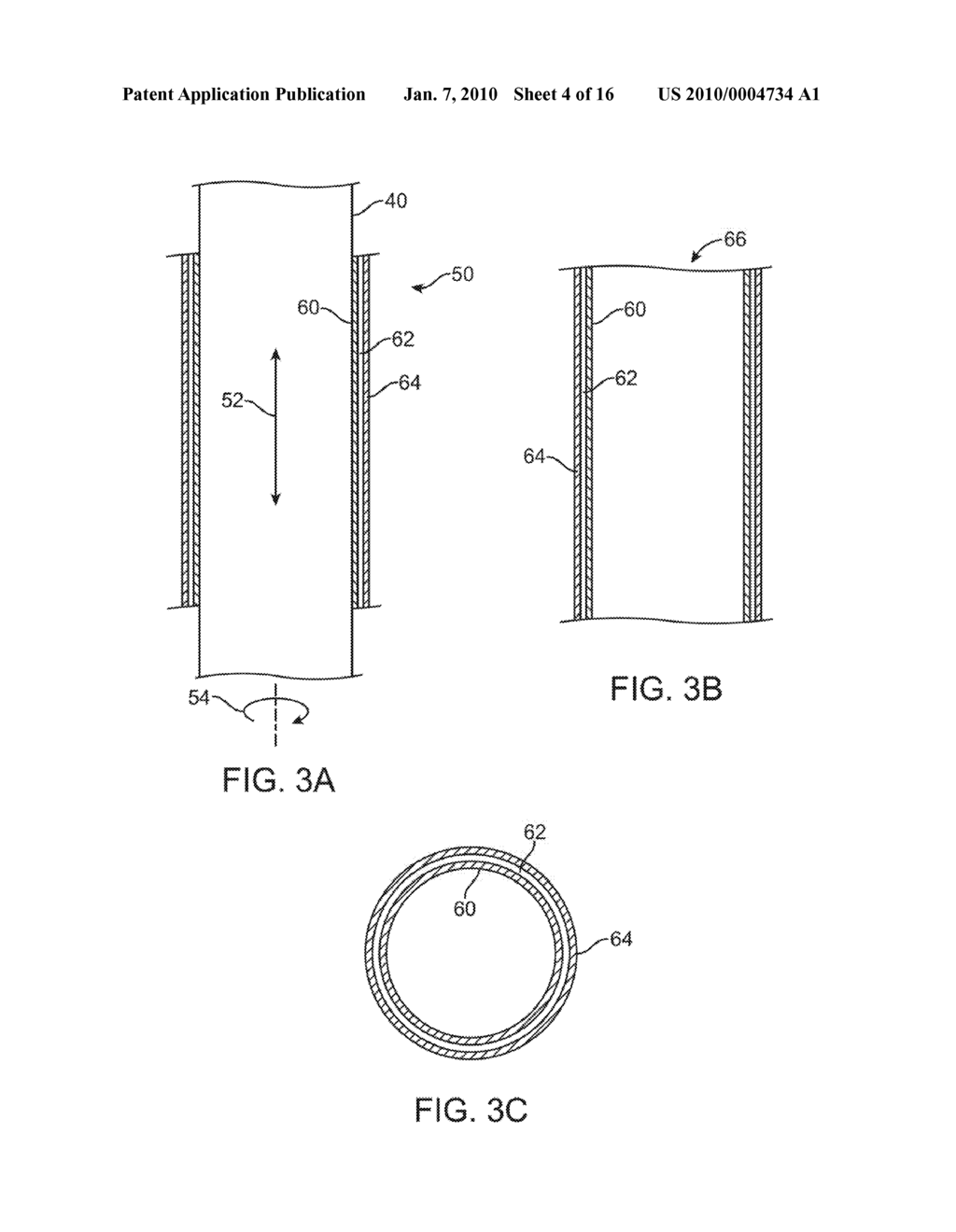 STENT FABRICATION VIA TUBULAR CASTING PROCESSES - diagram, schematic, and image 05