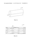 STENT FABRICATION VIA TUBULAR CASTING PROCESSES diagram and image