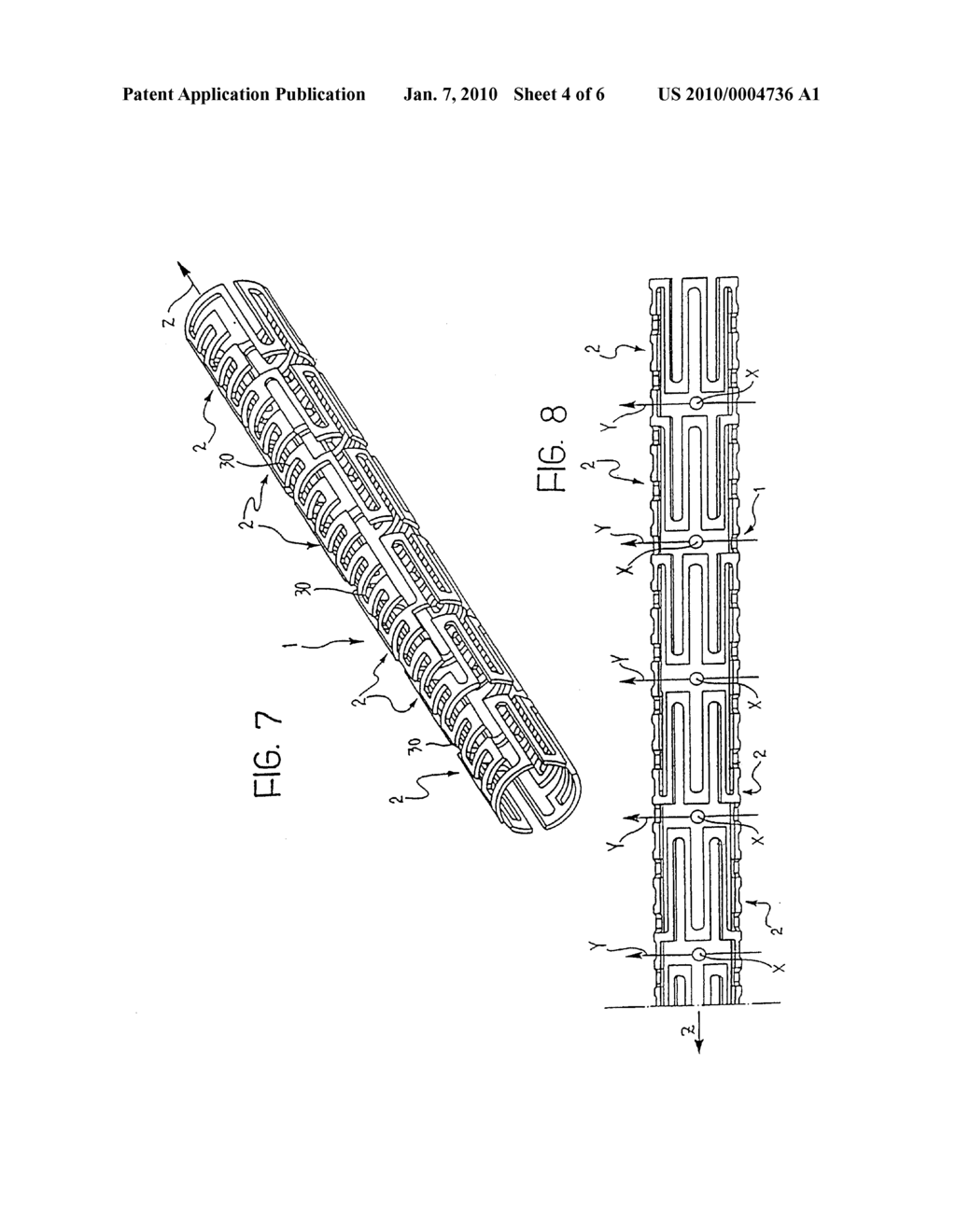 ANGIOPLASTY STENTS - diagram, schematic, and image 05