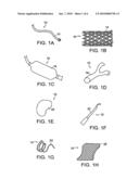 DRUG DELIVERY COATING FOR USE WITH A MEDICAL DEVICE AND METHODS OF TREATING VASCULAR INJURY diagram and image