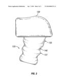 Talar implants and methods of use diagram and image