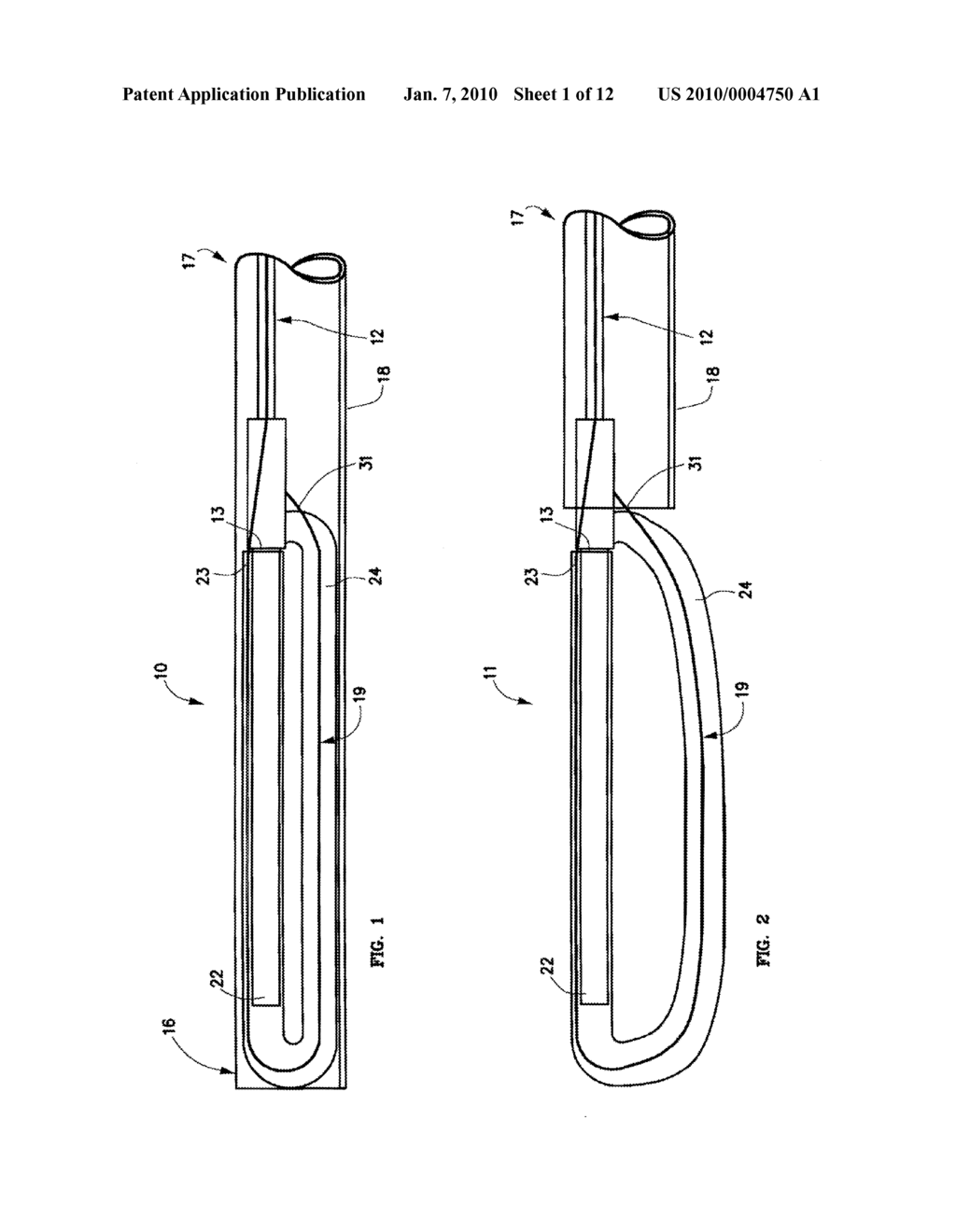 Mechanical apparatus and method for artificial disc replacement - diagram, schematic, and image 02