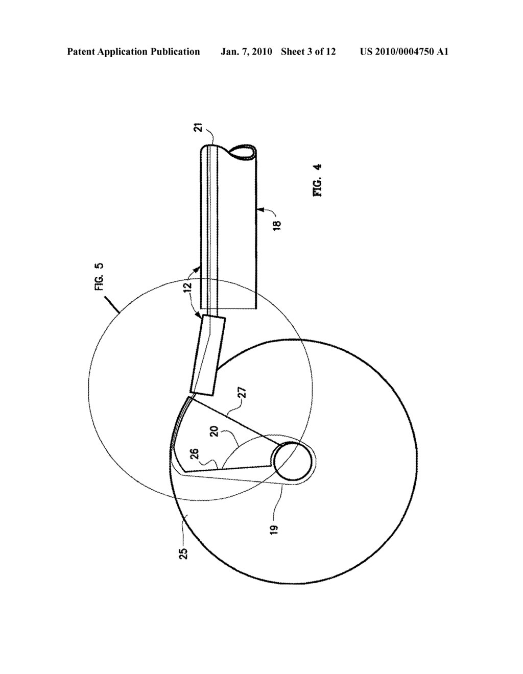 Mechanical apparatus and method for artificial disc replacement - diagram, schematic, and image 04