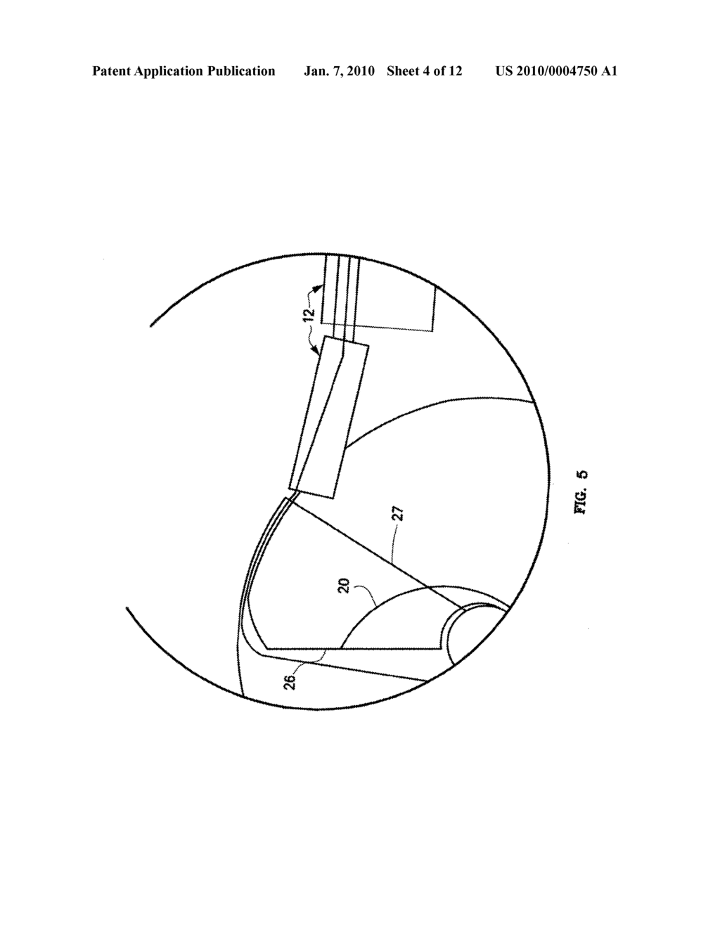 Mechanical apparatus and method for artificial disc replacement - diagram, schematic, and image 05