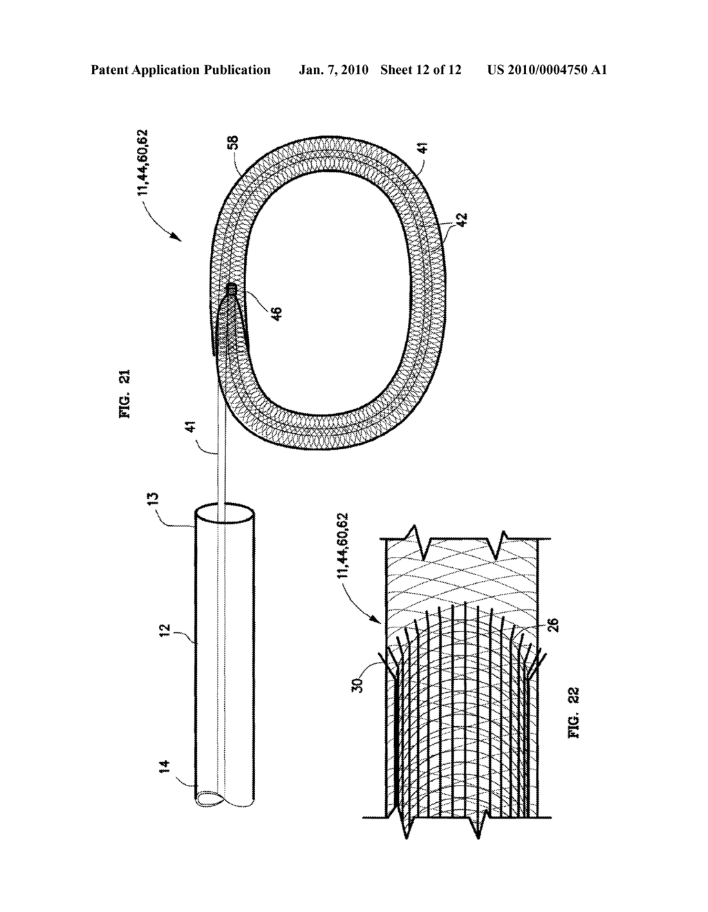 Mechanical apparatus and method for artificial disc replacement - diagram, schematic, and image 13