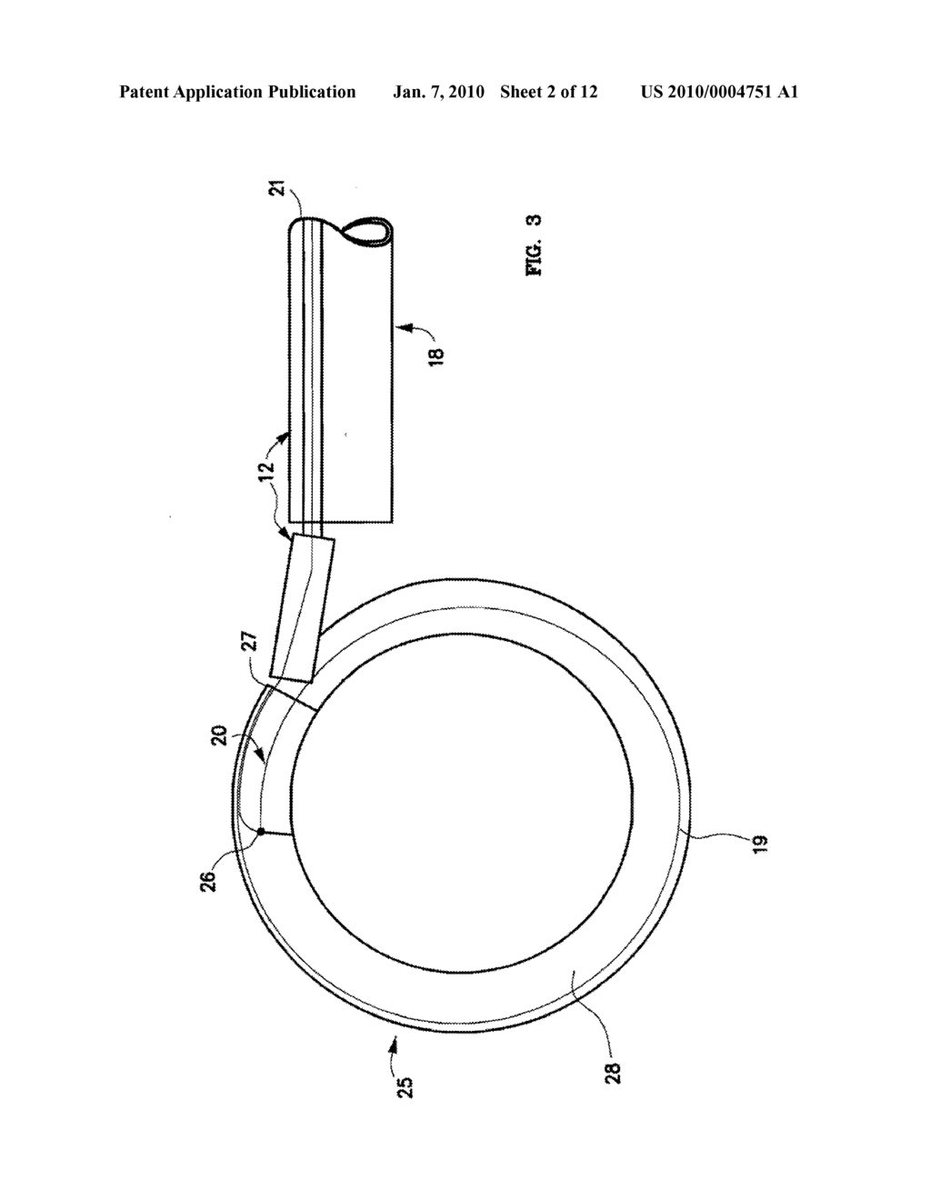 Mechanical apparatus and method for artificial disc replacement - diagram, schematic, and image 03