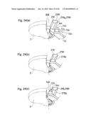 Withdrawing mechanism diagram and image