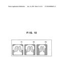 RADIOGRAPHIC IMAGING CONTROL APPARATUS USING MULTI RADIATION GENERATING APPARATUS diagram and image