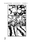 USE OF TGF-BETA ANTAGONISTS TO TREAT INFANTS AT RISK OF DEVELOPING BRONCHOPULMONARY DYSPLASIA diagram and image