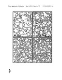 USE OF TGF-BETA ANTAGONISTS TO TREAT INFANTS AT RISK OF DEVELOPING BRONCHOPULMONARY DYSPLASIA diagram and image