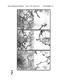 USE OF TGF-BETA ANTAGONISTS TO TREAT INFANTS AT RISK OF DEVELOPING BRONCHOPULMONARY DYSPLASIA diagram and image