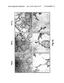 USE OF TGF-BETA ANTAGONISTS TO TREAT INFANTS AT RISK OF DEVELOPING BRONCHOPULMONARY DYSPLASIA diagram and image