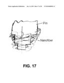 ELECTROSPUN STRUCTURES AND METHODS FOR FORMING AND USING SAME diagram and image