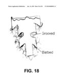 ELECTROSPUN STRUCTURES AND METHODS FOR FORMING AND USING SAME diagram and image