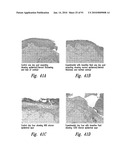 BACTERIOSTATIC OR BACTERIOCIDAL COMPOSITIONS AND METHODS diagram and image