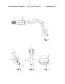 ACOUSTICALLY ACTIVATED DENTAL INSTRUMENT diagram and image