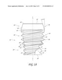 COMPACT DENTAL IMPLANT diagram and image