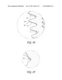 COMPACT DENTAL IMPLANT diagram and image