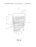 COMPACT DENTAL IMPLANT diagram and image