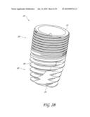 COMPACT DENTAL IMPLANT diagram and image