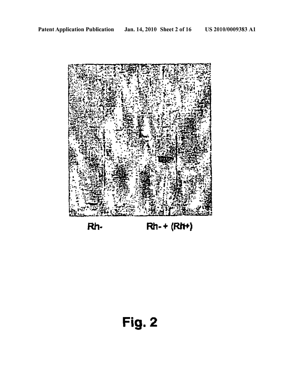 Method for the simple and rapid detection of cells and biomolecules by means of paramagnetic particles - diagram, schematic, and image 03