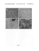 Novel population of multipotent cardiac precursor cells derived from human blastocysts derived stem cells diagram and image